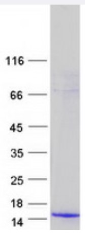 SDS PAGE (PMAIP1-3049H).jpg
